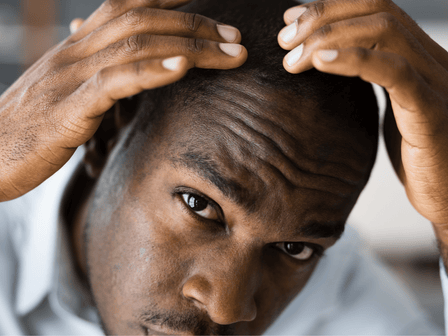 The effect of Ketoconazole and Piroctone olamine on hair growth
