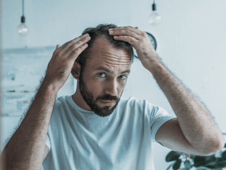Types of hair loss